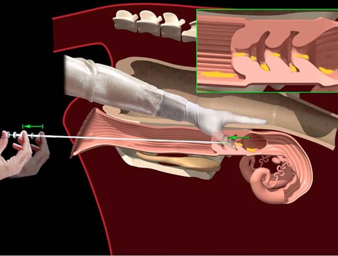 Suni Tohumlama Uygulaması
